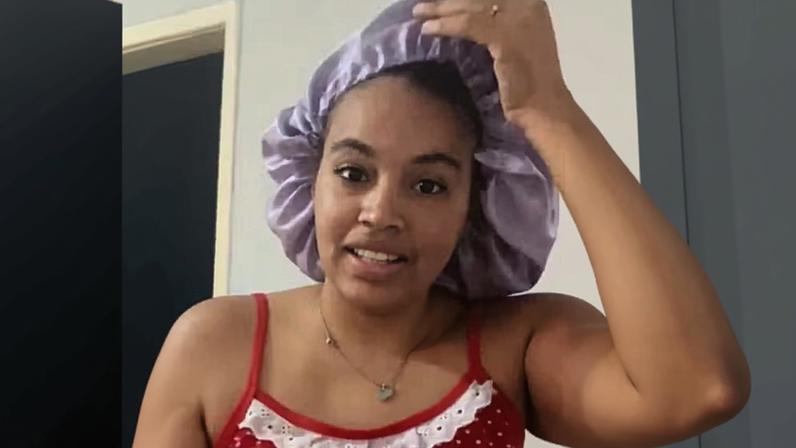 Thalita ficou com uma infecção na testa — Foto: Reprodução/Instagram