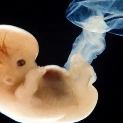 Visão do Guardian sobre humanos editados geneticamente: usos sombrios e médicos