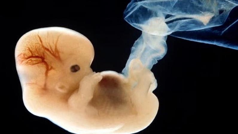 ‘A majority of citizens in the UK, Spain and the Netherlands supported the use of gene editing to correct life-threatening genetic conditions.’ A six-week-old human embryo.