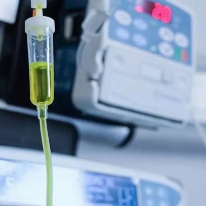 Hemodiálise: como funciona e sua importância para a qualidade de vida