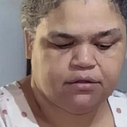 Lucimeire enfrenta cirurgia que pode aliviar dor e mudar sua vida