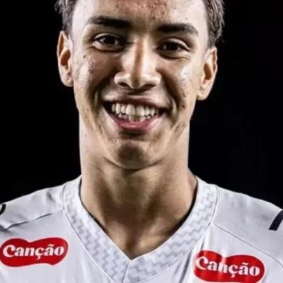 Cuca tem desfalque no Santos devido a problema de saúde