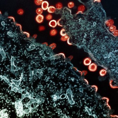HIV: dois novos casos de cura são anunciados
