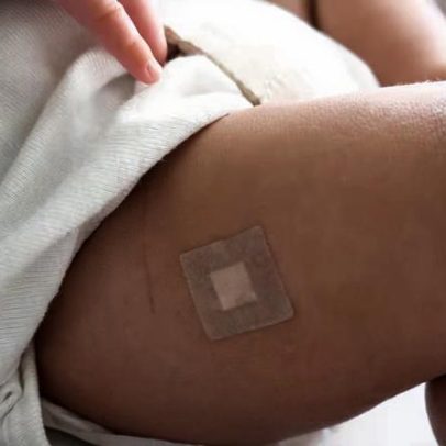 Pneumo 20 chega ao SUS: saiba tudo sobre a nova vacina