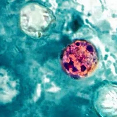 Parasita que provoca diarreia explosiva já infectou mais de 300 nos EUA