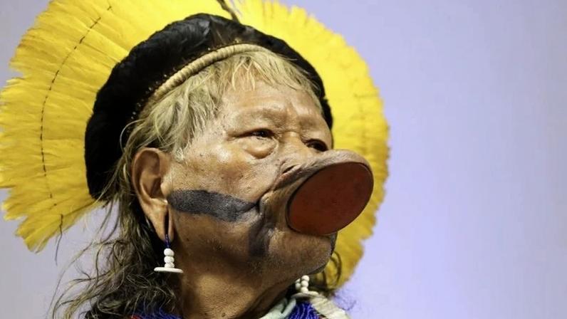 Cacique Raoni tem saúde estável e respira sem ajuda de aparelhos