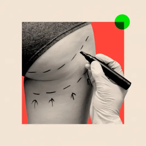 BBC A montage image shows photograph of a hand in a white latex glove holding a black marker pen and marking a woman's right buttock and thigh with two broken lines and a row of three arrows pointing upwards. The photograph is in black and white and there is a red background, with a beige border and a green dot in the top right-hand corner.
