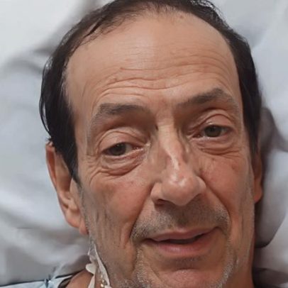 Marcos Oliveira, o Beiçola, fala sobre cirurgia: dor e sofrimento