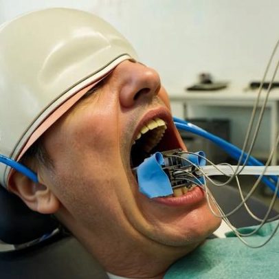 Conheça o robô odontológico para perfuração de dentes