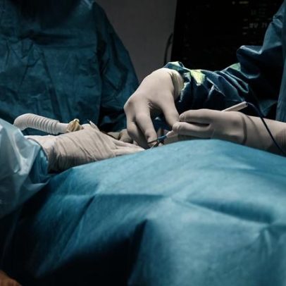 Tratamento minimamente invasivo com calor elimina tumor no fígado