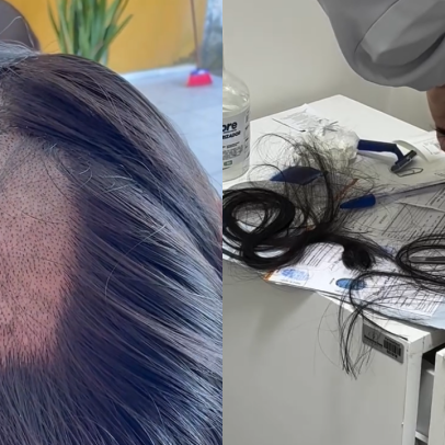Exame toxicológico: mulheres denunciam corte excessivo de cabelo; entenda