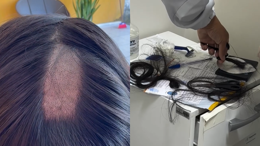 Exame toxicológico: mulheres denunciam corte excessivo de cabelo; entenda