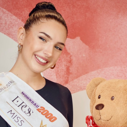 Miss Áustria morre aos 22 anos após lutar contra doença cardíaca