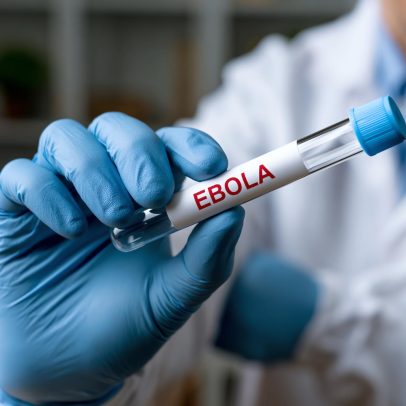 Nigéria registra 1º caso de ebola em meio a surto na Rep. Dem. do Congo