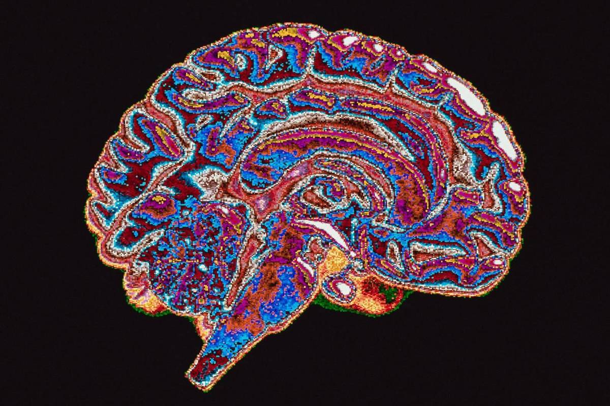 Cientistas analisam a natureza corrupta do ser humano e suas implicações sociais A neurociência começou a explorar como o poder político e o contexto institucional influenciam a atividade cerebral associada a decisões corruptas ou imorais. (Foto: Getty Images)
