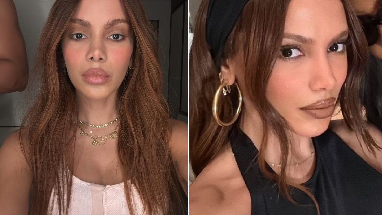 Anitta enfrenta desafios após cirurgia plástica inspirada em Michael Jackson Anitta e seu novo visual - (Reprodução/Instagram)
