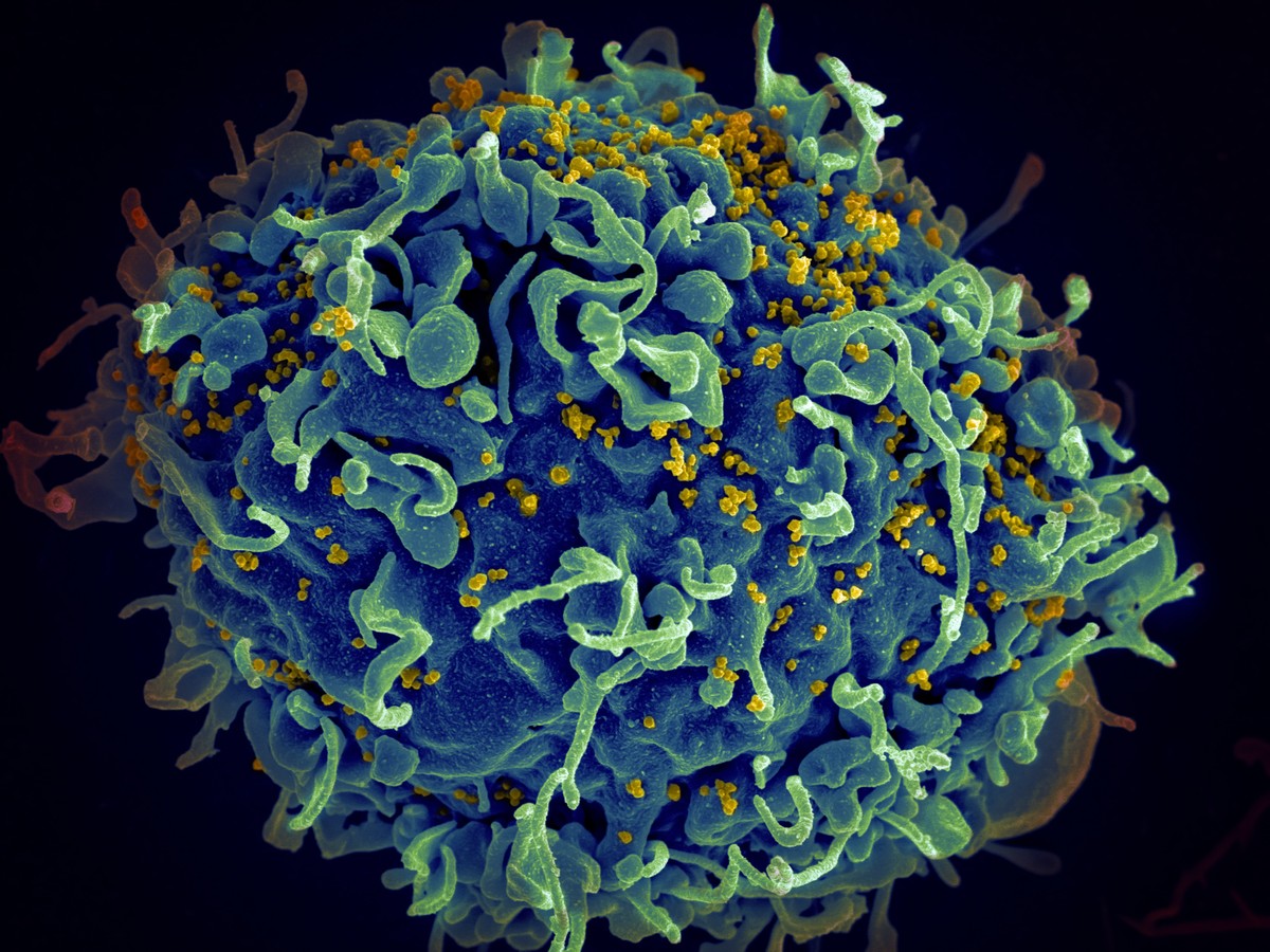 O vírus do HIV (amarelo), infectando uma célula humana. (Foto: National Cancer Institute / Unsplash)