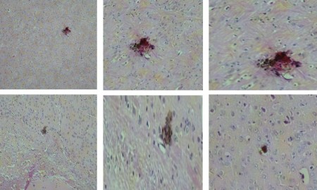 Lâminas histológicas com regiões do cérebro apresentando pontos de necrose nos animais não vacinados e infectados com vírus zika (Foto: Nelson Côrtes et al./NPJ Vaccines)