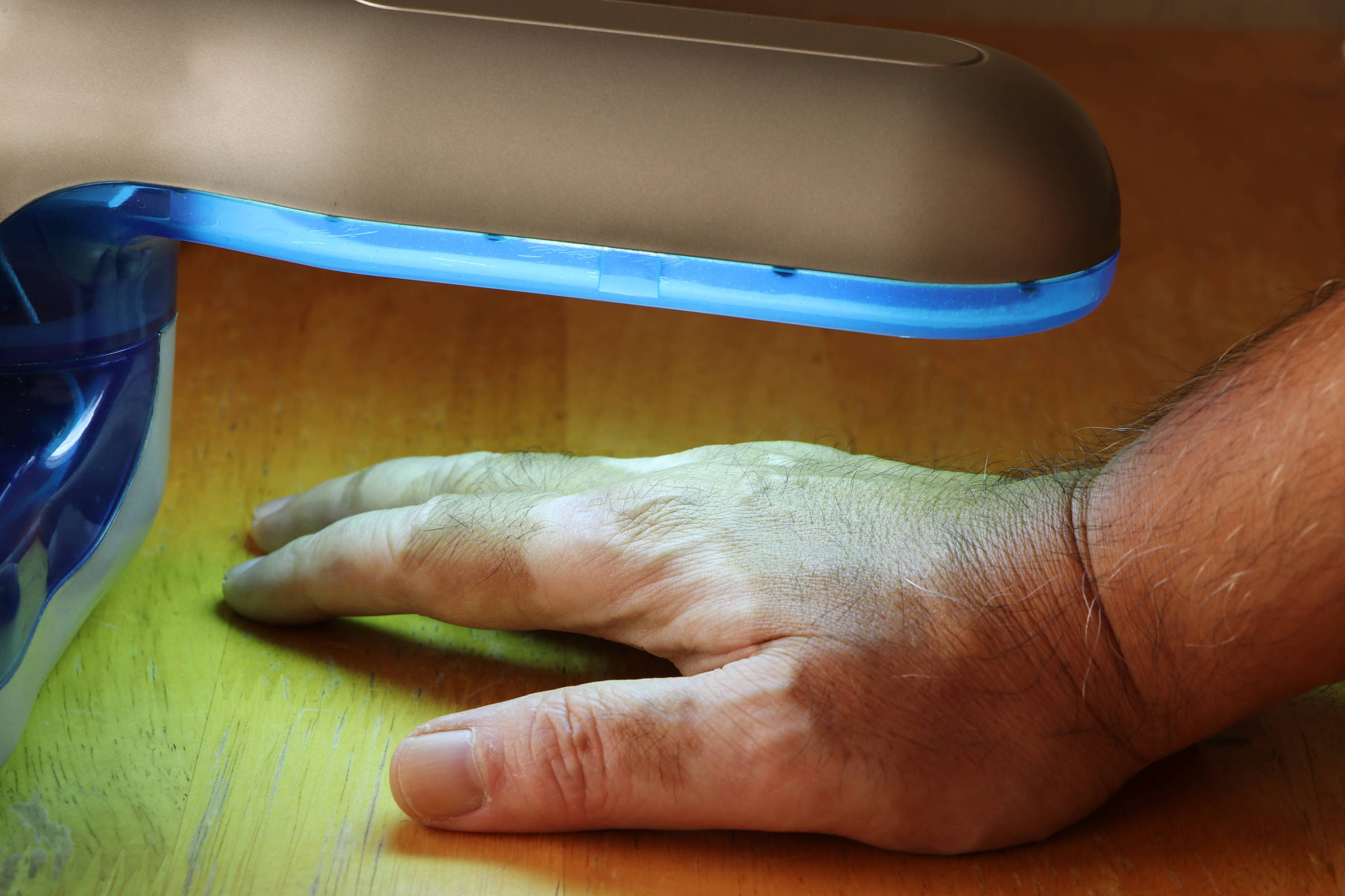 Oito estados brasileiros adotam fototerapia para tratar vitiligo em pacientes Fototerapia utilizada em tratamento de vitiligo (Foto: Virachit Kalambasuta/Adobe Stock)