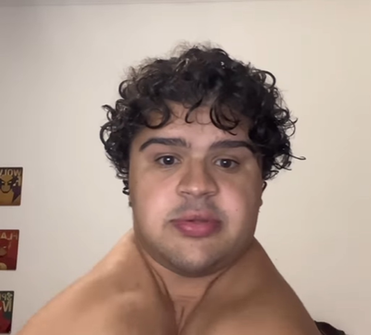Influenciador compartilha rotina com displasia cleidocraniana e viraliza na internet