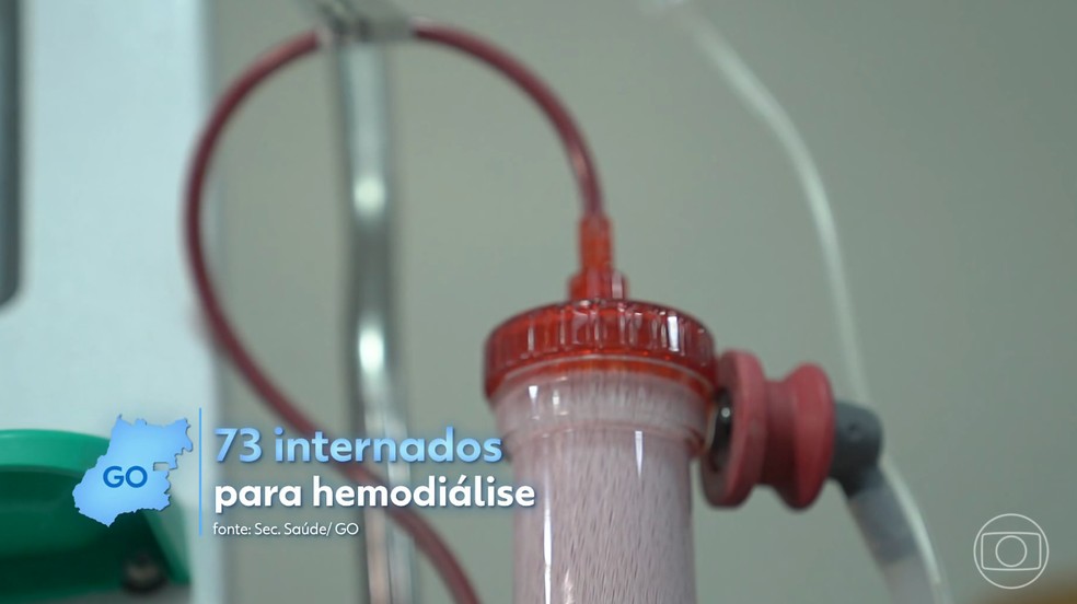 Sistema de saúde enfrenta colapso na hemodiálise e gera internações desnecessárias