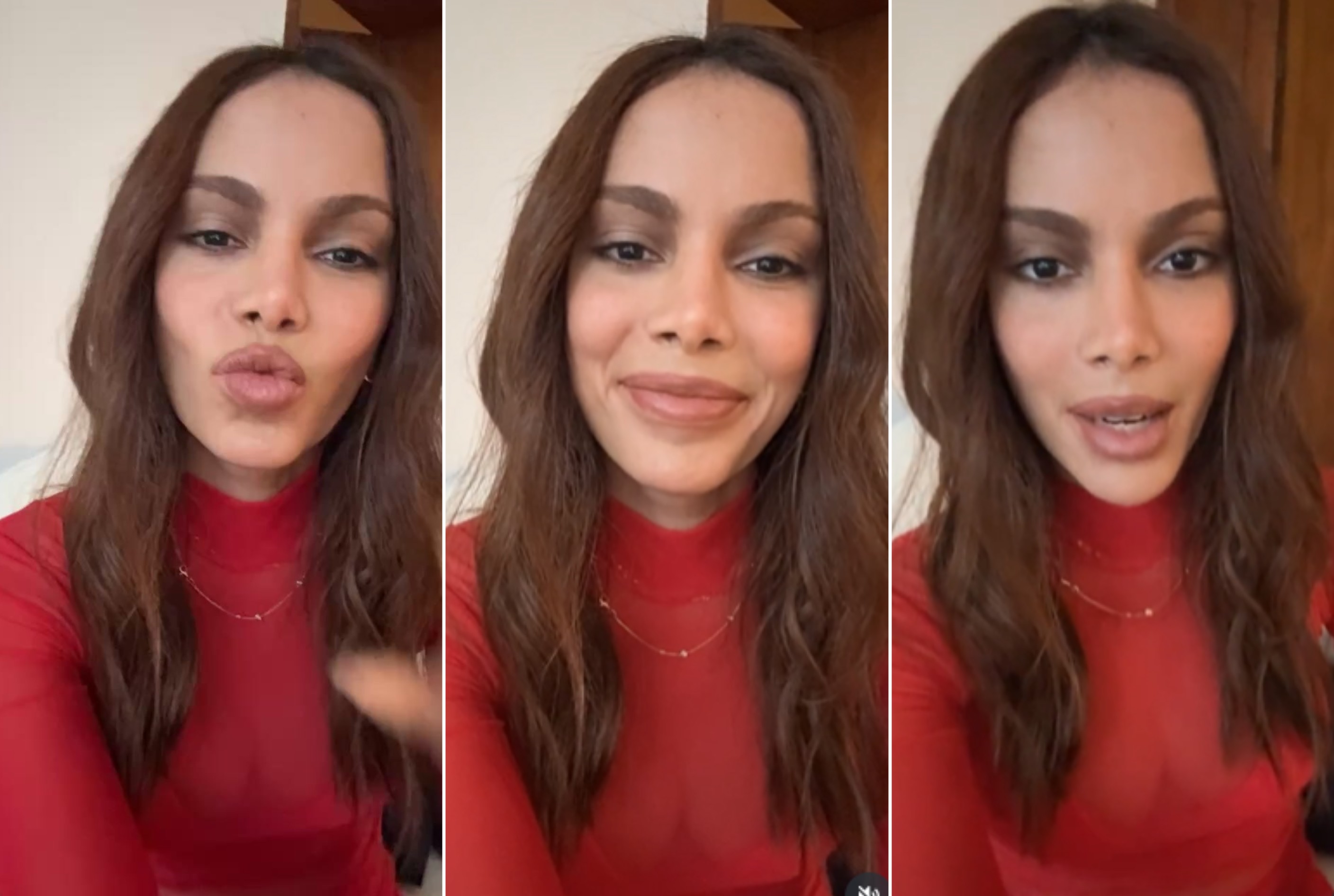 Anitta fala sobre procedimentos faciais e seu impacto na carreira musical Foto: Reprodução