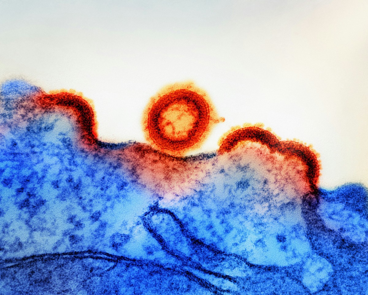 O HTLV infecta o mesmo tipo de célula que o HIV – as células T, um tipo de célula imune sanguínea que ajuda o corpo a combater infecções. (Foto: Unsplash)