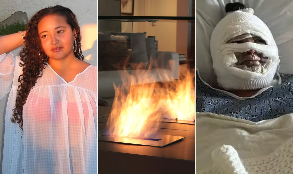 Lareira a álcool causa explosão e deixa jovem de 18 anos com rosto desfigurado A última postagem de Viana Poggi no Instagram é de poucos dias antes do acidente com a lareira a álcool — Foto: Reprodução/ Instagram/Hudson Pontes / Agência O Globo / Arquivo/ GoFundMe