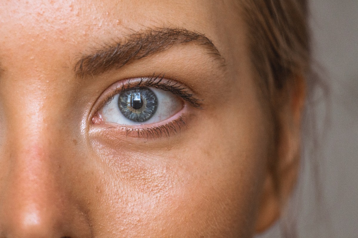 Nevo ocular: entenda os cuidados necessários para evitar complicações na saúde dos olhos
