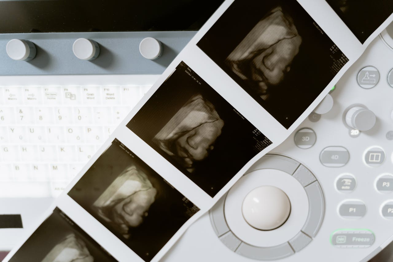 Irlanda atinge recorde histórico com quase 11 mil abortos em 2024