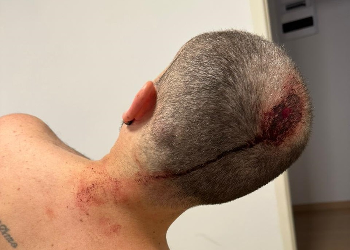Homem relata ameaça de tiro e fuga em situação de risco iminente Músico Léo Moreno foi agredido em assalto na Barra com duas coronhadas: ladrões queriam celular (Foto: Foto do leitor)