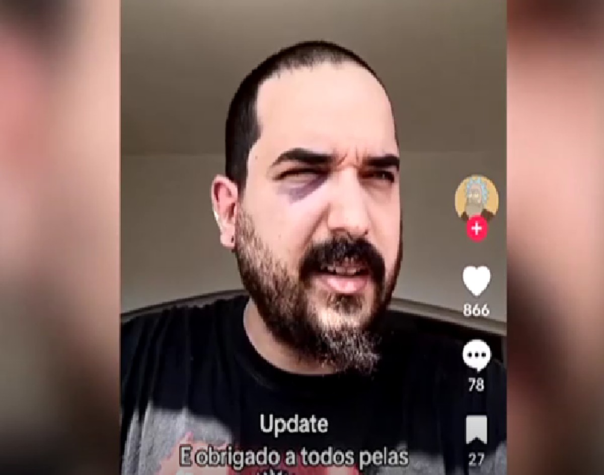 Ricardo em vídeo publicado em rede social: olho roxo e, segundo ele, fratura no maxilar (Foto: Reprodução)