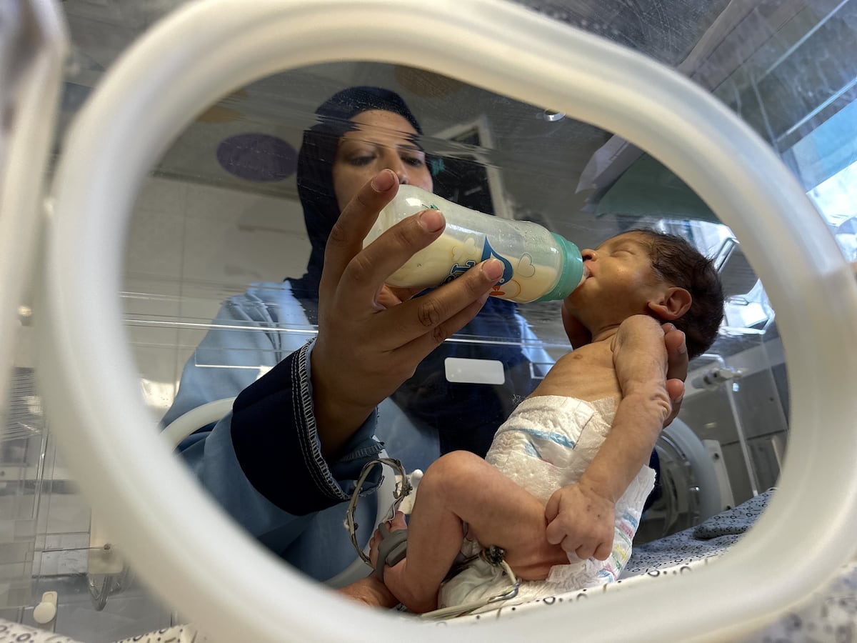 Bebês de Gaza enfrentam fome sem leite em fórmula disponível Um bebê prematuro recebe tratamento no Hospital Nasser, de Gaza, no dia 19 de junho. (Foto: Anadolu via Getty Images)