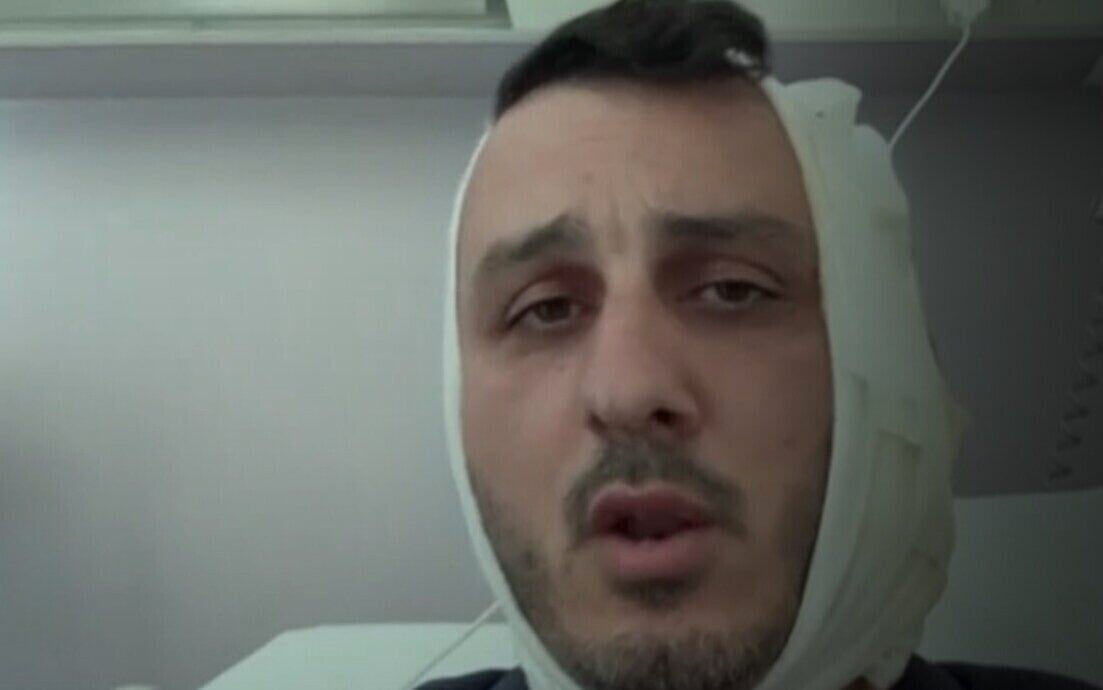 Turista israelense perde orelha em ataque na Grécia por homem que se diz do Hamas Stav Ben-Shushan após receber atendimento hospitalar por ferimento na orelha. (Foto: Canal 12)