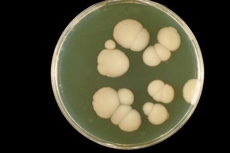 Combinação de inativação fotodinâmica com anfotericina B combateu com sucesso o fungo Candida albicans, obtendo redução de 75% em sua forma de levedura e 87,5% na de hifa (Foto: Wikipedia)