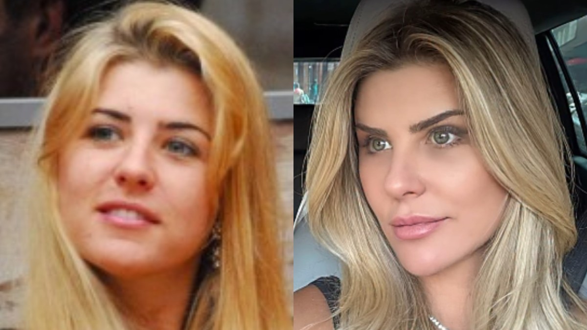 Íris Stefanelli revela novo visual natural após procedimento estético inovador Íris Stefanelli aposta em lifting facial para visual natural; entenda a técnica com especialistas (Foto: Reprodução Globo/Instagram)