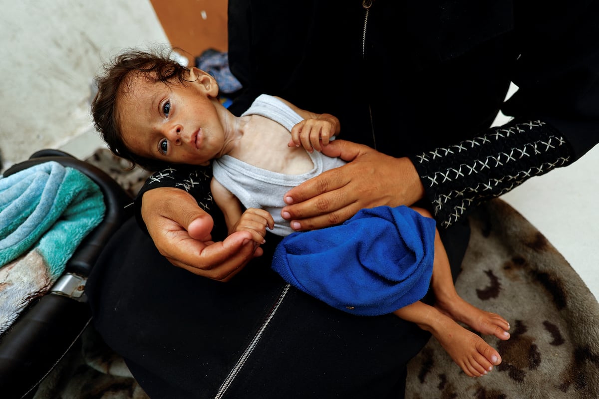 Ammar, de cinco meses, em um hospital de Gaza. (Foto: Mahmoud Issa/REUTERS)
