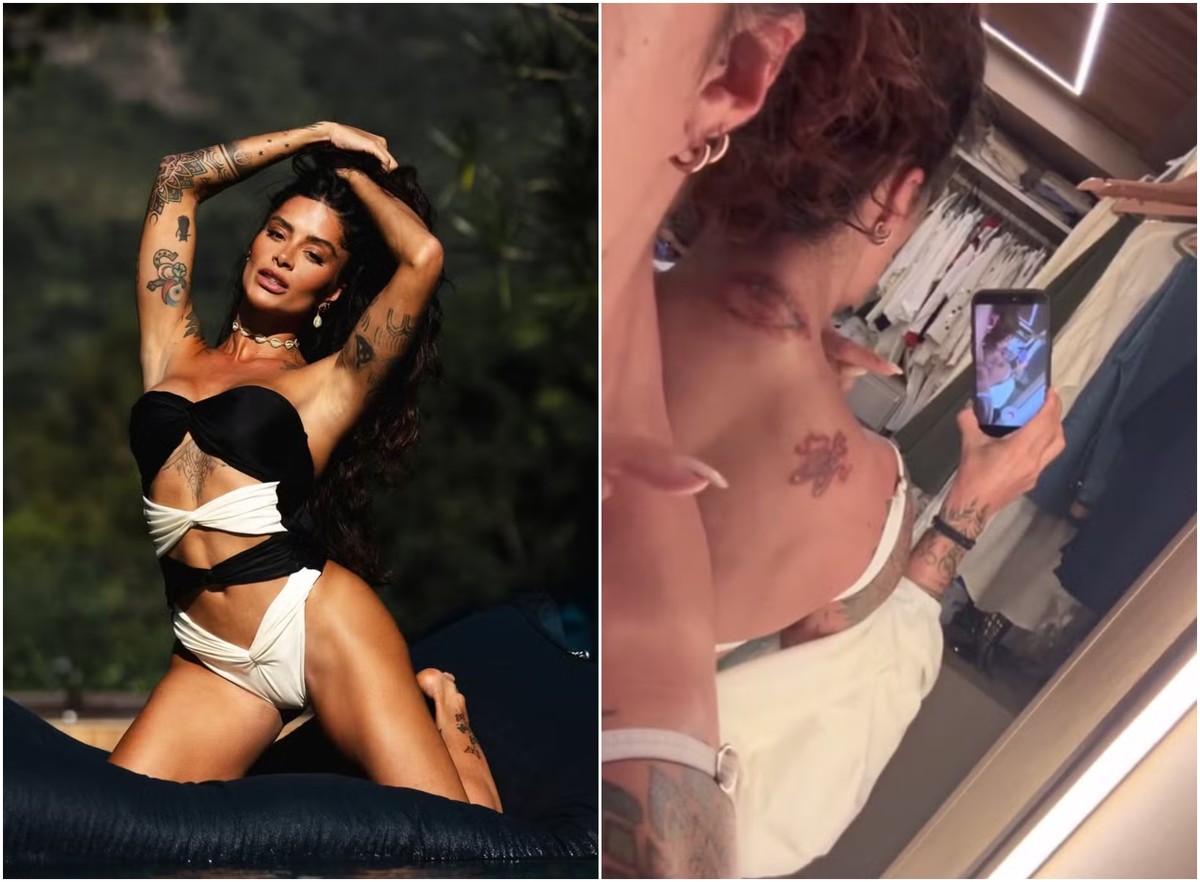 Aline Campos revela desafios e dores do processo de remoção de tatuagens Aline Campos conta processo de remoção de tatuagens (Foto: Reprodução/Instagram)
