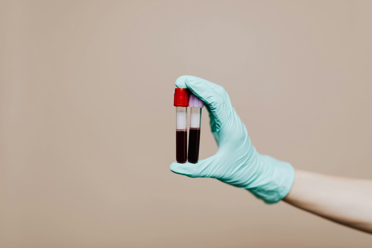 Cientistas revelam os surpreendentes benefícios do sangue tipo O para a saúde O sangue O⁺ (O positivo) é um dos tipos sanguíneos mais comuns do mundo (Foto: Pexels)