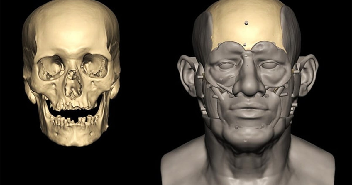 Cientistas revelam segredos do DNA de egípcio da época das pirâmides Pesquisadores sequenciaram genomas inteiros dos dentes de um esqueleto bem preservado encontrado em um pote funerário (Foto: Caroline Wilkinson/Liverpool John Moores University)