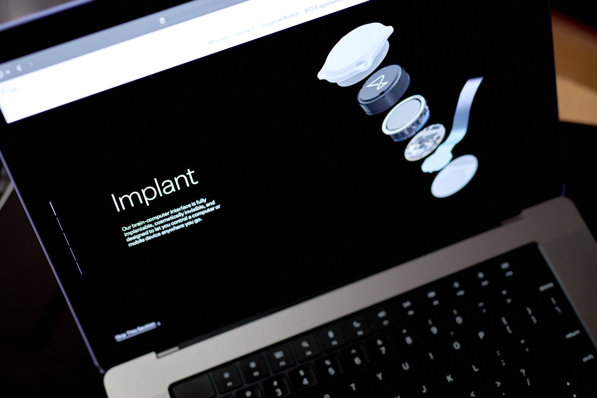 Estudo da Neuralink testa tecnologia que permitiria que pessoas paralisadas controlassem um braço robótico (Foto: Bloomberg)