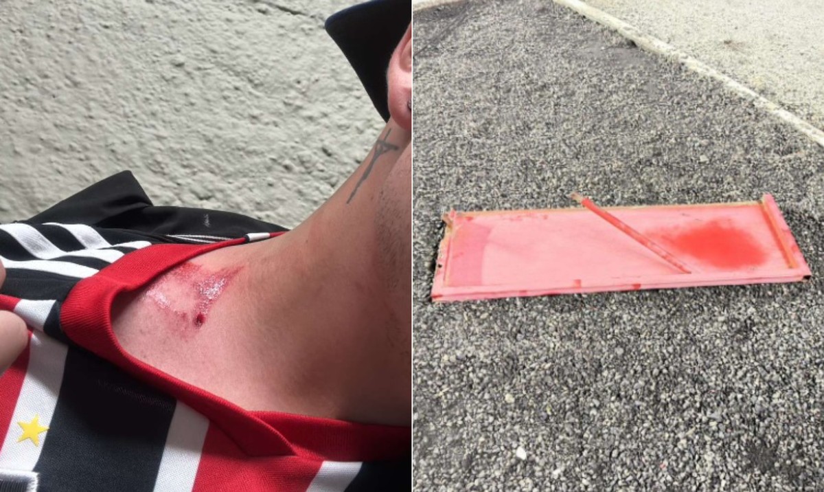 Torcedor reclama do tratamento dado pelo clube após o incidente (Foto: Reprodução)