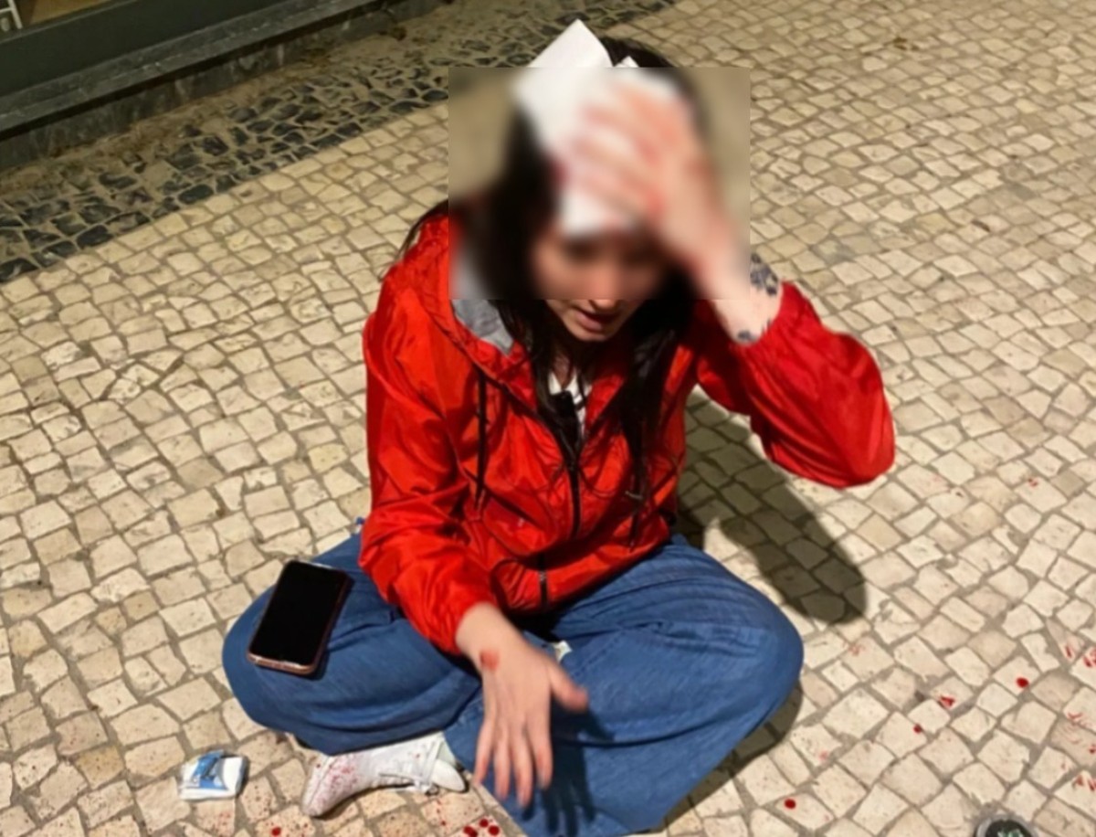 Brasileira é agredida com pedrada na cabeça durante caminhada em Portugal Brasileira diz ter sido agredida com pedrada na cabeça em Portugal (Foto: Reprodução/Threads)