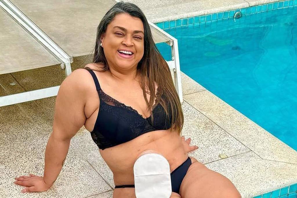 Aumento na busca por colonoscopia em SP após falecimento de Preta Gil A cantora Preta Gil usou uma bolsa de colostomia durante o tratamento contra o câncer (Foto: Reprodução/Instagram)