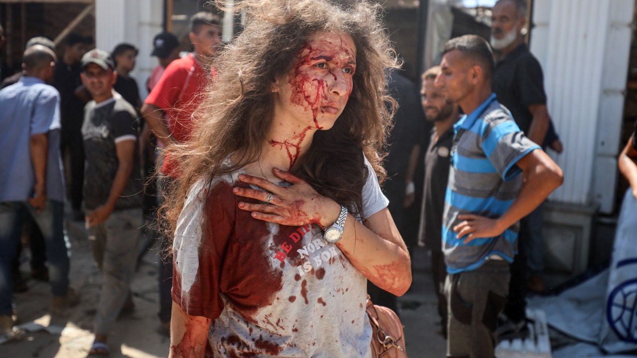 Ataque israelense a café em Gaza resulta em pelo menos 24 mortos e muitos feridos Mulher fica ferida após ataque aéreo israelense a café Al-Baqa, na Cidade de Gaza. 30/06/2025 (Foto: Majdi Fathi/NurPhoto/Getty Images)