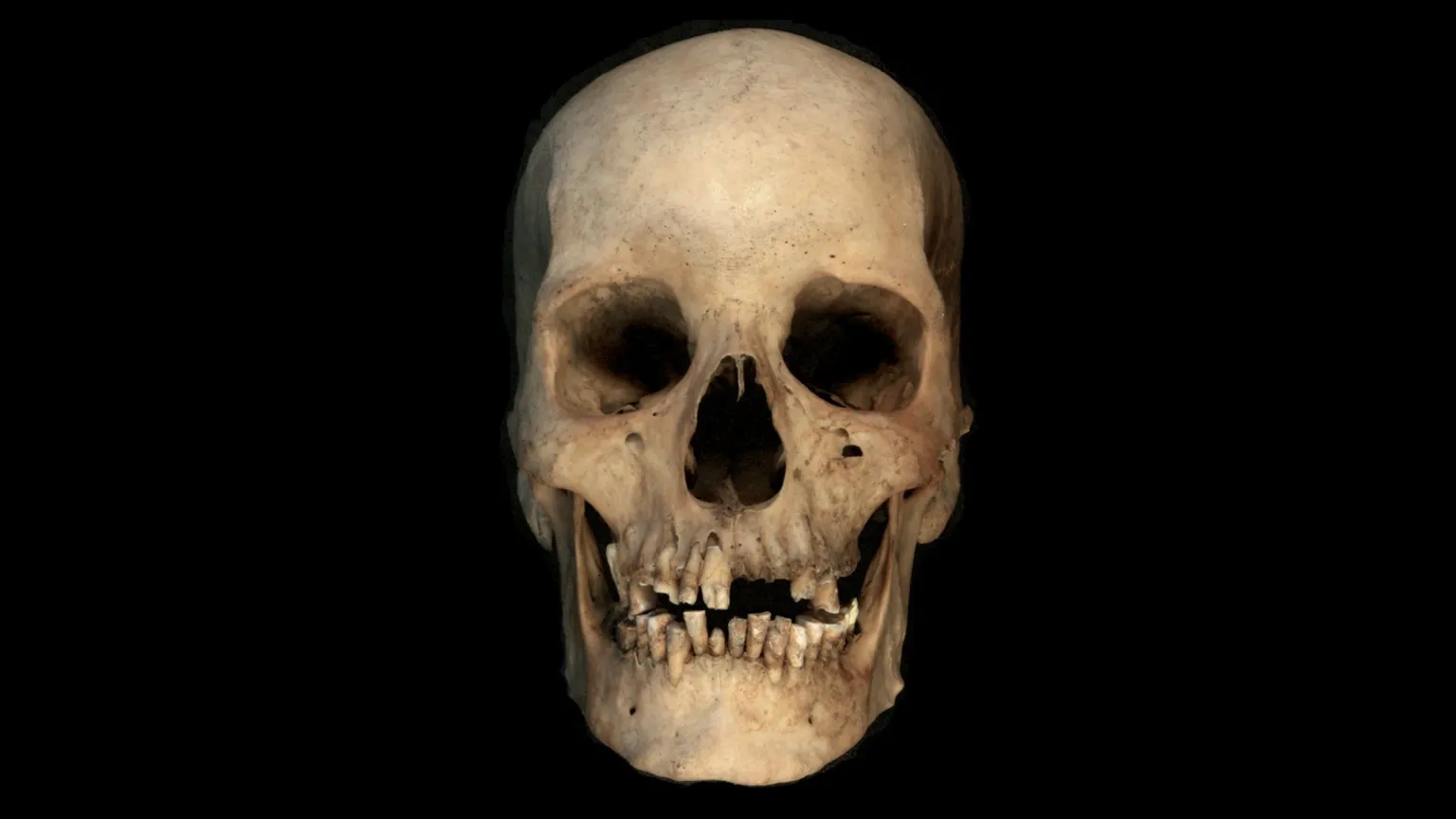 Antigos ossos revelam novos detalhes sobre a ascensão do Egito Antigo Testes no crânio podem fornecer novas percepções sobre a história antiga (Foto: Liverpool John Moores University. Nature)