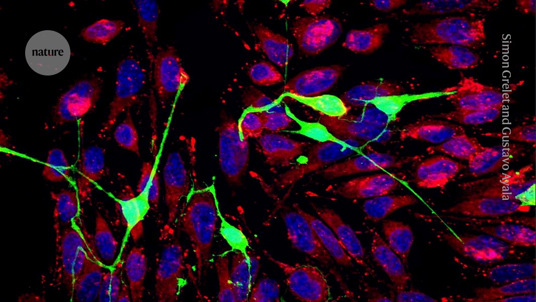 Células cancerígenas (vermelhas, com seus núcleos corados de azul) crescem tubos finos para siphonar mitocôndrias de células nervosas (verdes). (Foto: Simon Grelet e Gustavo Ayala)