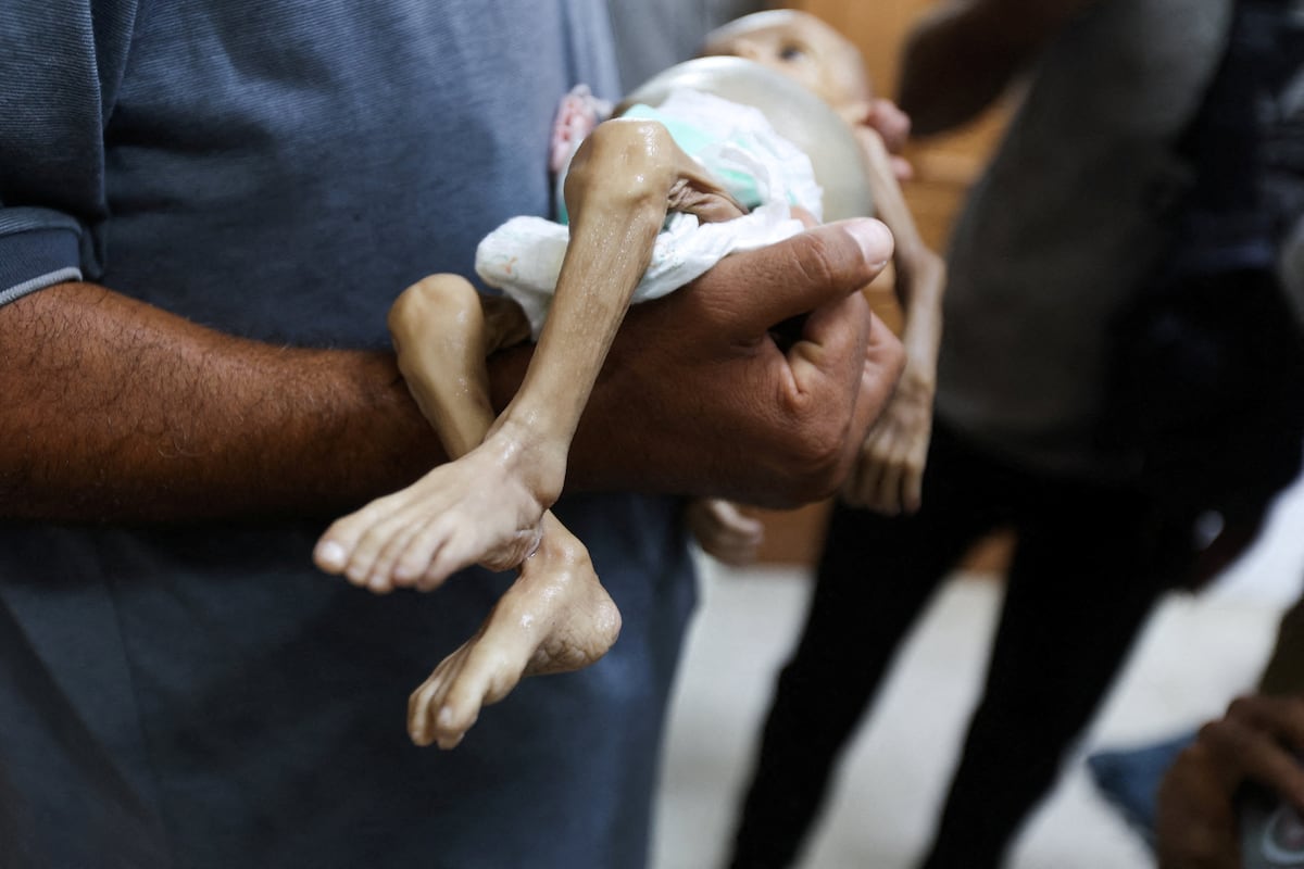 B’Tselem denuncia genocídio de Israel em Gaza e quebra tabu no país Um homem transporta o corpo da menina palestina de curta idade Zainab Abu Haleeb, que morreu por desnutrição aguda severa em Jan Yunis (Gaza), no último sábado. (Foto: Ramadan Abed/REUTERS)