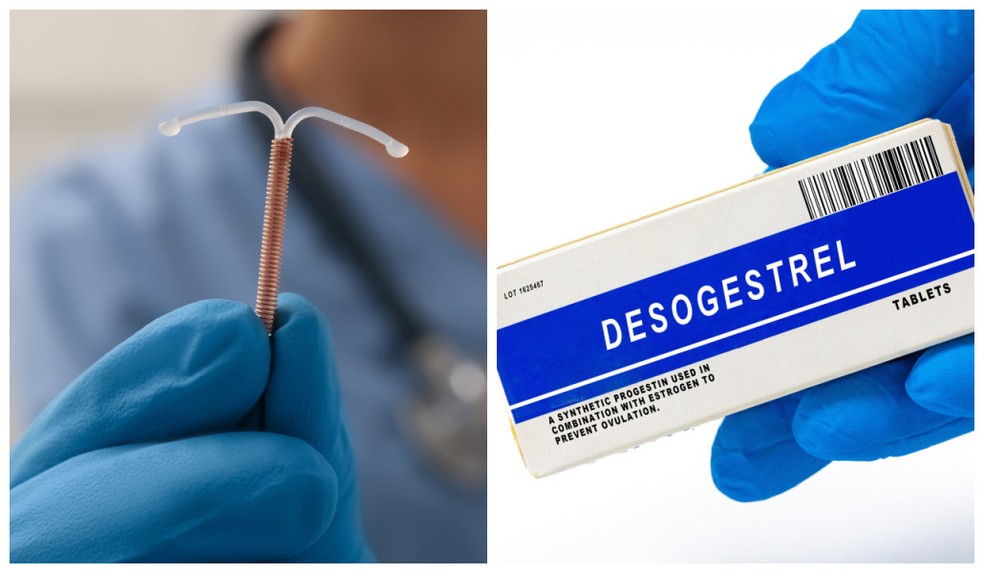 SUS inclui dois novos tratamentos hormonais para endometriose e beneficia pacientes Dispositivo Intrauterino liberador de levonorgestrel (DIU-LNG) à esquerda e Desogestrel à direita — Foto: Adobe Stock