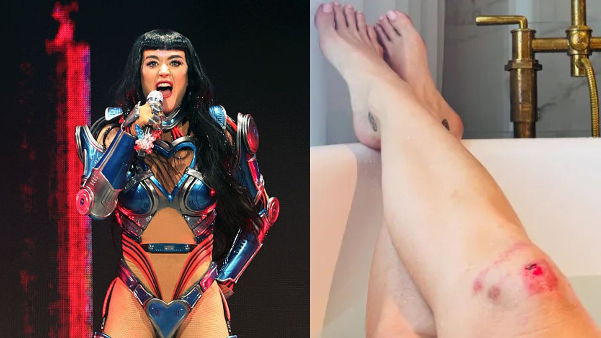 Katy Perry mostrou os ferimentos enquanto relaxava em uma banheira (Foto: Getty Images/Instagram)